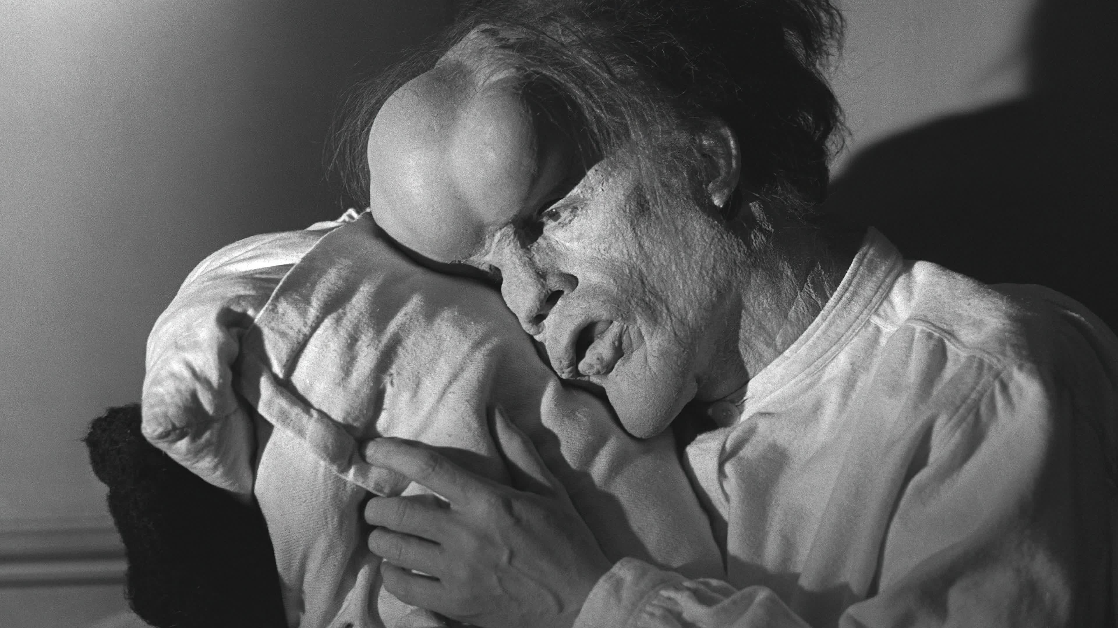 The Elephant Man (1980)